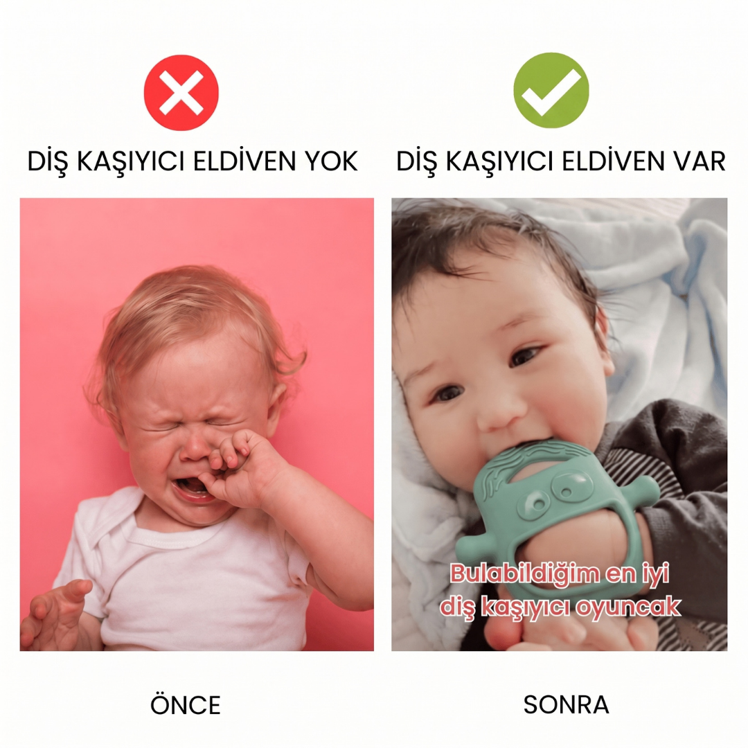 GloryBaby®-Diş Kaşıma Eldiveni